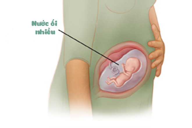 Dư ối - Hình ảnh minh họa